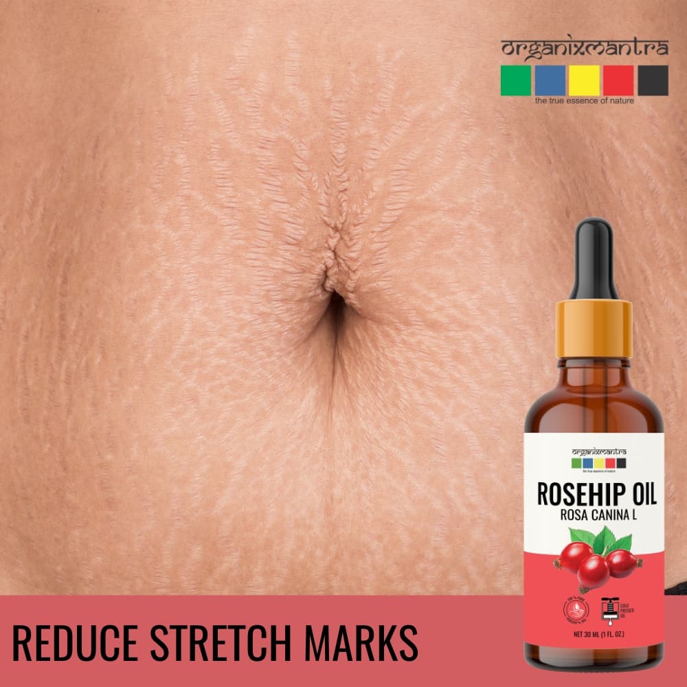 Rosehip Seed Organic Cold Pressed Oil - Image 10